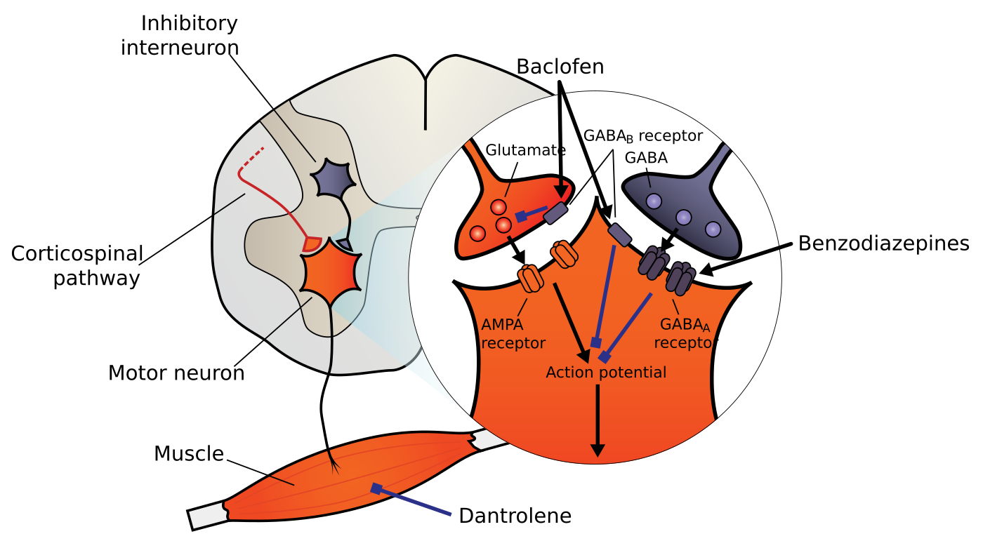 Educational diagram of spinal cord and muscle pathways involved in spasticity.
